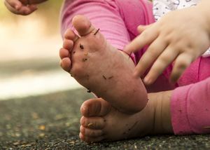 Understanding toe walking in children