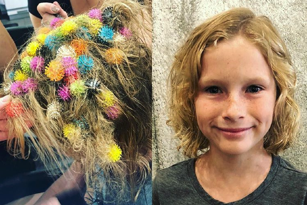 Mom warns parents after child gets 150 'Bunchems' stuck in hair - Good  Morning America