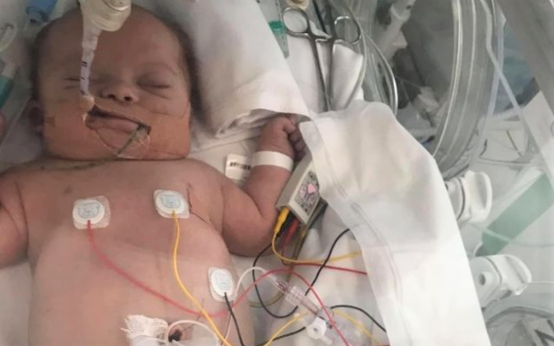 Heartbreaking appeal for baby Poppy - can you help?