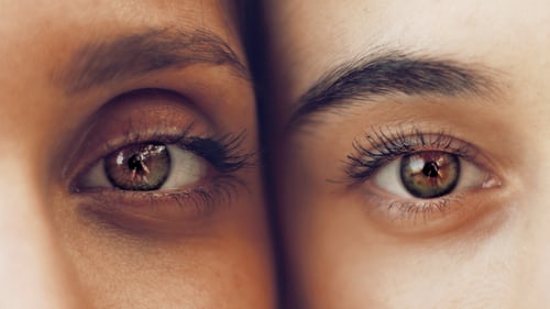 Dark circles that wont go away? Heres why more sleep isnt the answer
