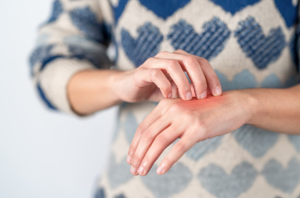 How can I get rid of psoriasis at home? 