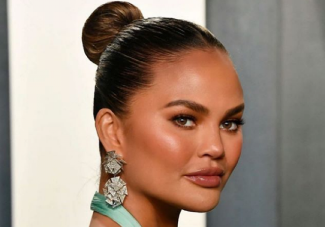Chrissy Teigen undergoes eyebrow transplant after years of over plucking