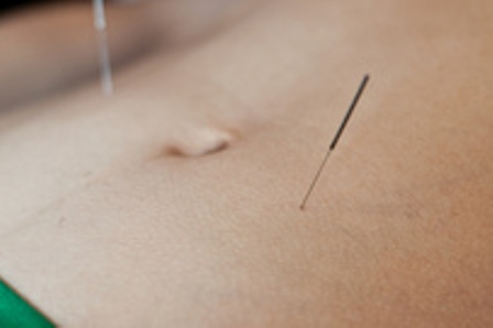 Anam Mai Acupuncture