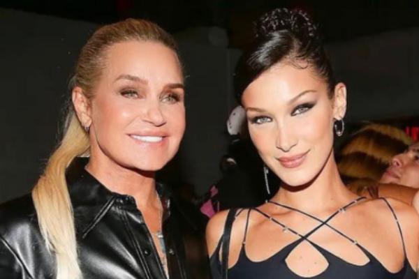 Yolanda Hadid criticized for allowing 14-year-old daughter to get a nose job