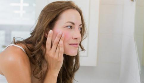 The low-down on rosacea - what is it & how should it be tackled?