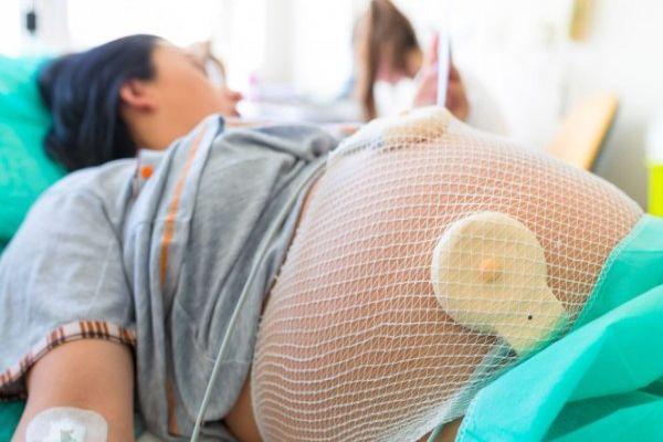 Obstetrician details potential causes behind huge increase in C-section births