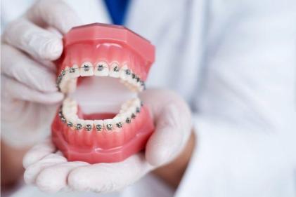 Six Myths about Orthodontics for Kids
