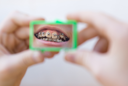 How to Handle an Orthodontic Emergency