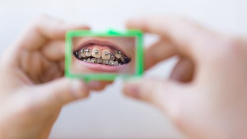 How to Handle an Orthodontic Emergency