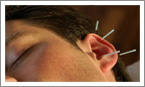 Acupuncture4Health - Skerries