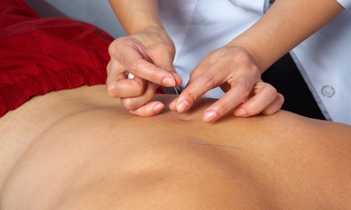 Mark Goulding Acupuncture - Glen of The Downs