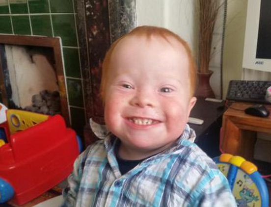 Toddler's smile 'bridges gap between disabled and non-disabled...