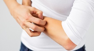 5 top tips for dealing with eczema