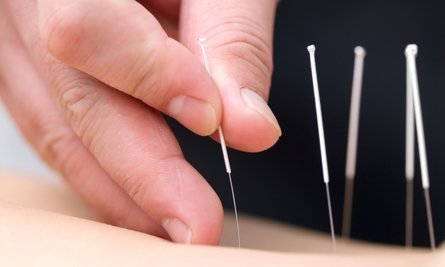 Zen Acupuncture - Dublin 