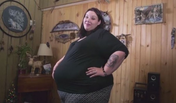 Increase In Complications Morbidly Obese Mum Pregnant